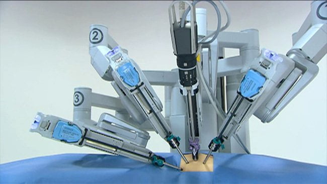 Read more about the article Understanding Robotic Surgery