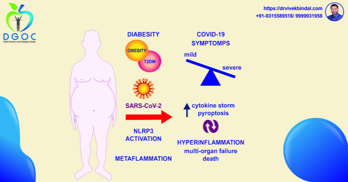 Read more about the article DIABESITY & COVID 19