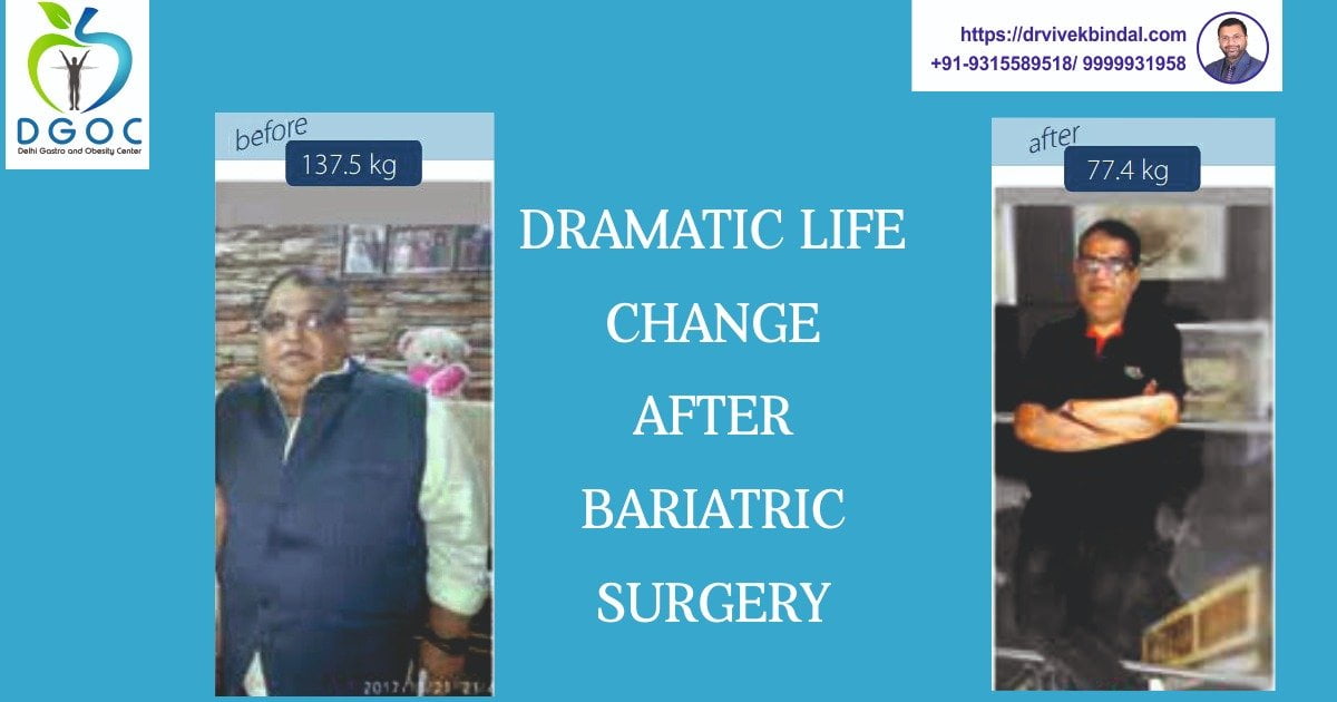 Read more about the article Dramatic life change after Bariatric Surgery